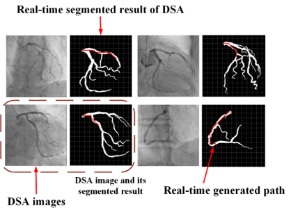 雪缘园足球比分